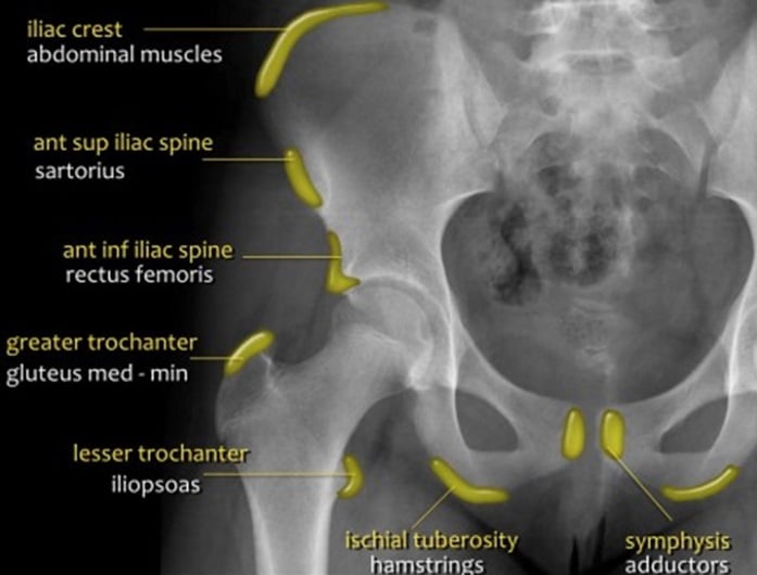 pain in hip but xray normal
