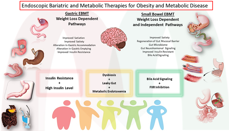 Obesity, diabetes, and fatty liver disease: Time to expand the toolbox ...