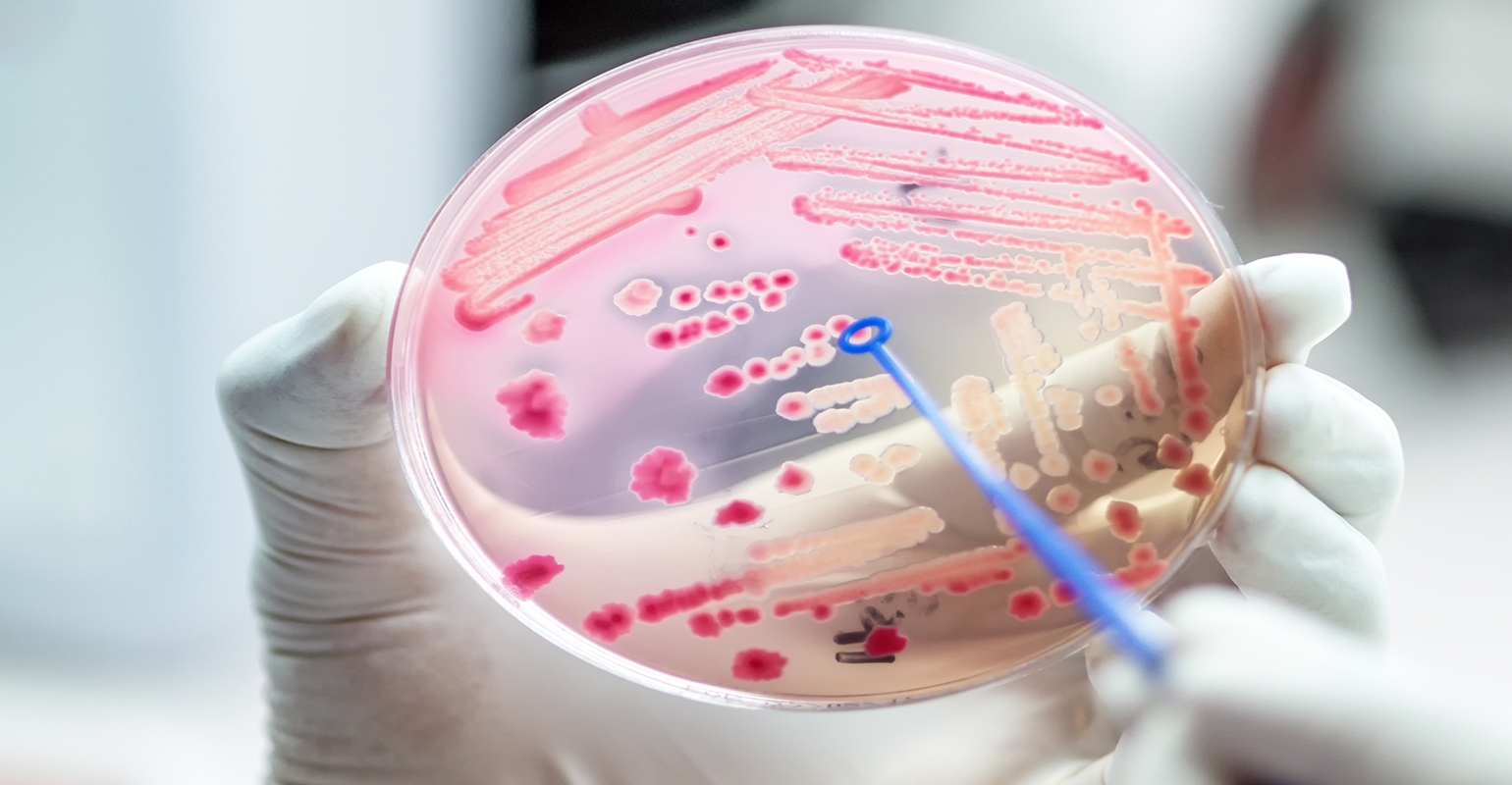 Antimicrobial resistance: a global threat