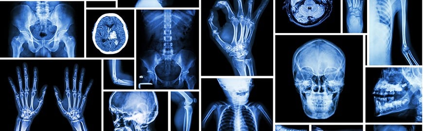 X-ray images of different body parts - X-ray Explained