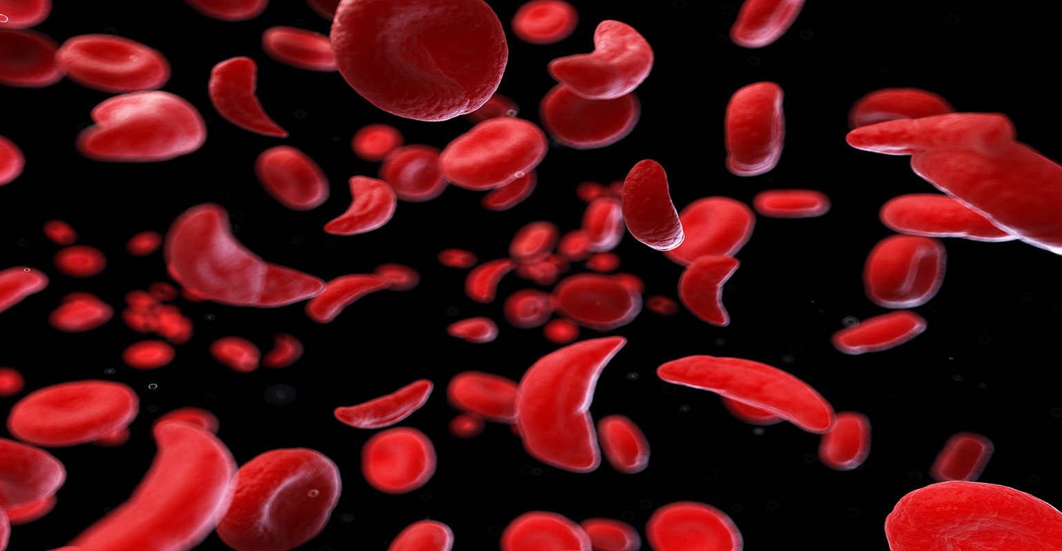 ohapi principles with sickle cell