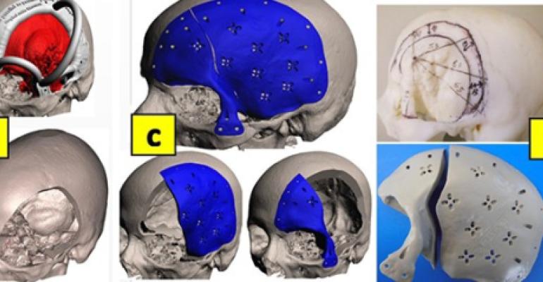 3d images of the brain